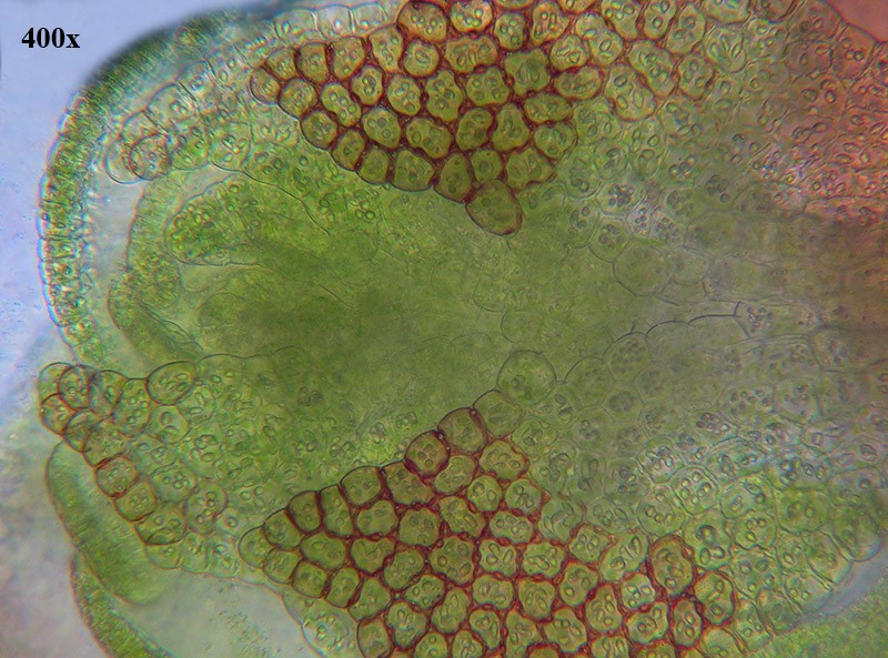 Calypogeia muelleriana?